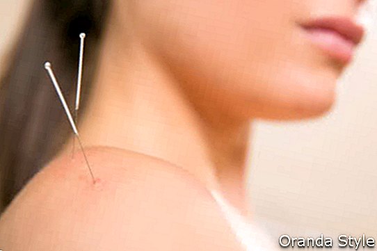 Akupunkturna igla je zbadala žensko ramensko terapijo