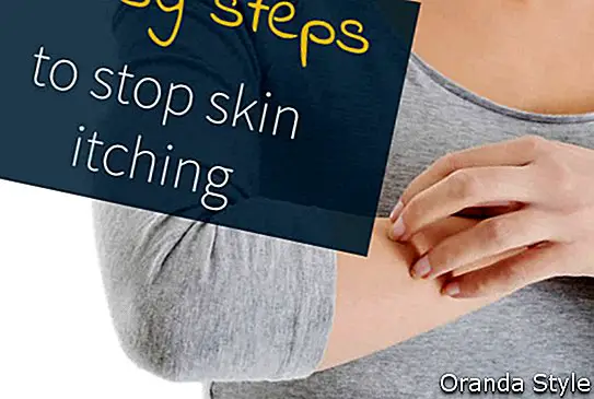 Neišgąsdinkite niežėjimo: kaip nustoti niežėti odą, kol ji nepadraugauja
