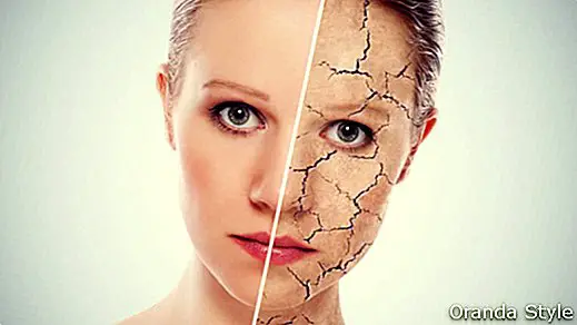 5 начина за излекуване на сухата кожа